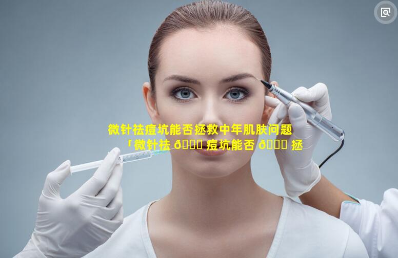 微针祛痘坑能否拯救中年肌肤问题「微针祛 🐎 痘坑能否 🕊 拯救中年肌肤问题呢」